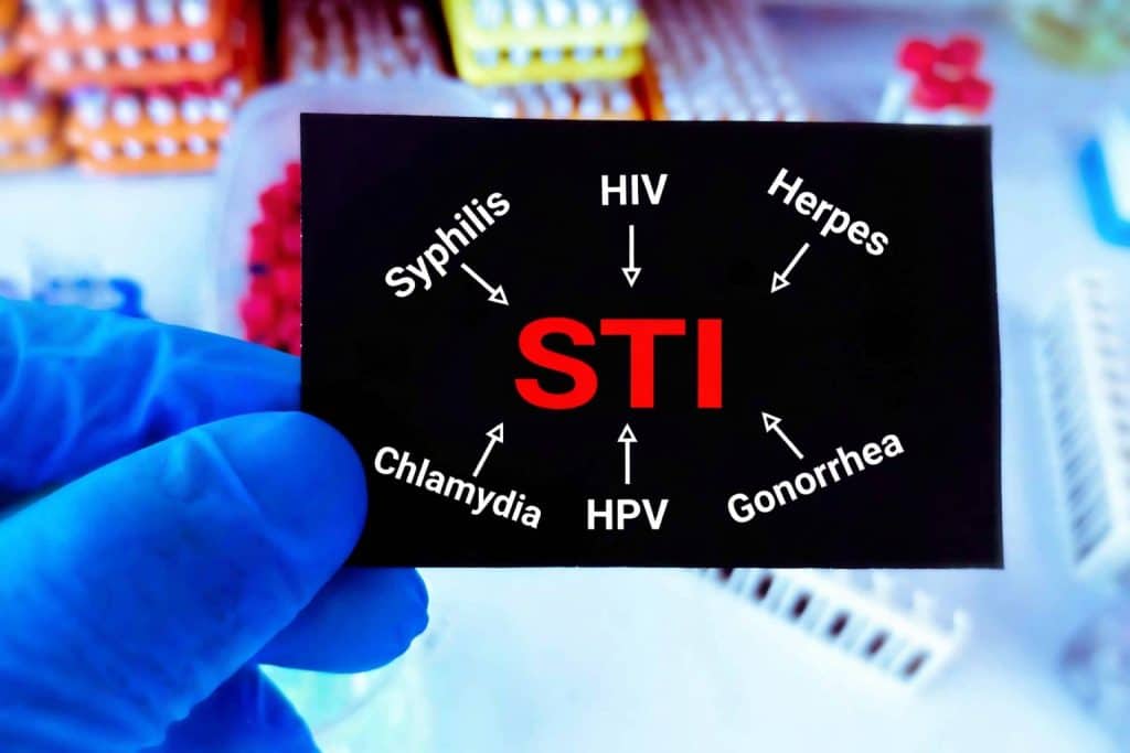 sti test